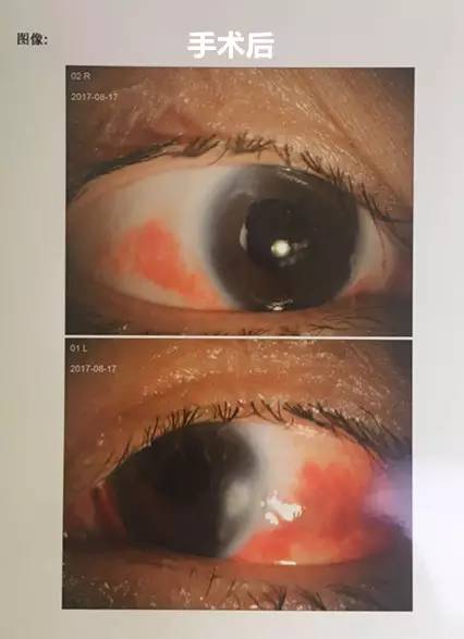 成都太阳成tyc122cc(中国)集团白内障.jpg