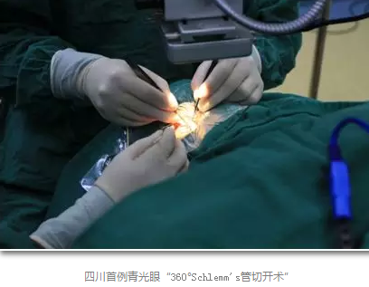 成都太阳成tyc122cc(中国)集团已经开展的青光眼手术有：引流阀 (钉)植入手术(2015年以来已200多 )，360°Schlemm's管切开术，激光CO2 辅助巩膜深层切除术，小梁切除术青(光眼)白(内障)联合手术。还有虹膜周切术、前房成形术、 虹膜复位术，睫状体冷冻术，小梁切开术和前房穿刺术等6.png