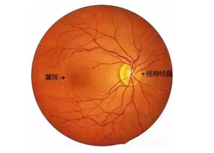 太阳成tyc122cc福州眼科医院眼底病医生：老年黄斑变性该如何防治？.png