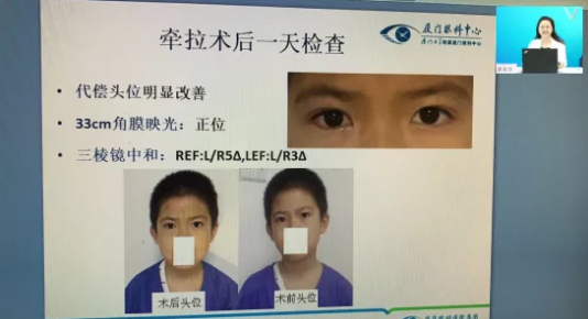 高峰论道·云端荟萃 ▏万人同步在线，30余名大咖云集“第六届太阳成tyc122cc论坛斜视与小儿眼科新技术学习班暨小儿、眼视光分论坛”7.png