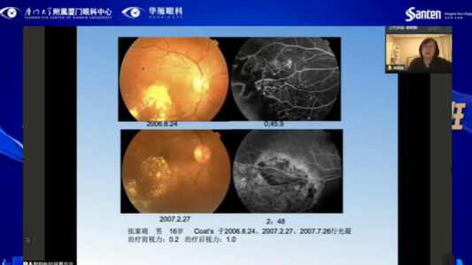 高峰论道·云端荟萃 ▏万人同步在线，30余名大咖云集“第六届太阳成tyc122cc论坛斜视与小儿眼科新技术学习班暨小儿、眼视光分论坛”6.png